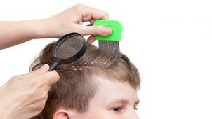 علاج قشرة شعر الطفل