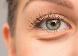 علاجات منزلية لالتهابات العيون