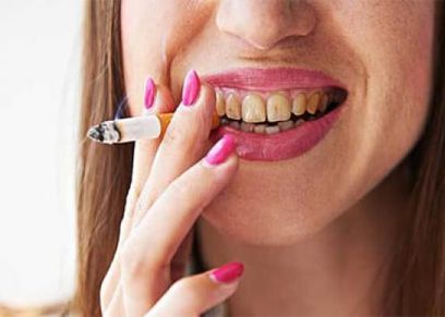 آثار التدخين على الأسنان