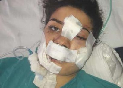 إسراء عماد ضحية عنف زوجها