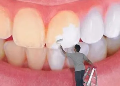 البقع البنية في الأسنان وعلاجها