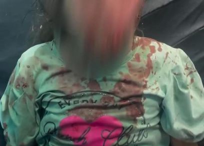 طفلة فلسطينية فقدت بصرها ضحية قوات الاحتلال