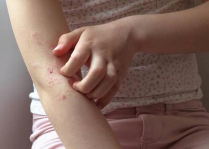 حساسية الجلد عند الأطفال
