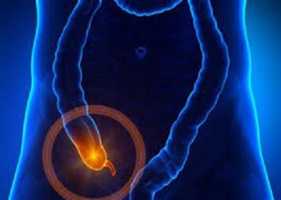 ماذا يحدث اذا انفجرت الزائدة الدودية؟