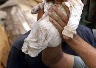 طفلة بملابس ملطخة بالدماء في مجزرة مستشفى المعمداني
