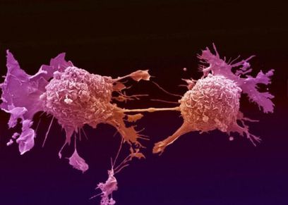 علاج جديد للسرطان