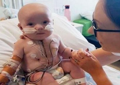 طفل يتحدى الأطباء ويعيش بنصف قلب بعد ولادته