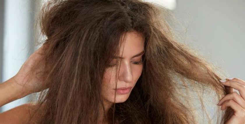 مشاكل الشعر عند الفتيات- تعبيرية