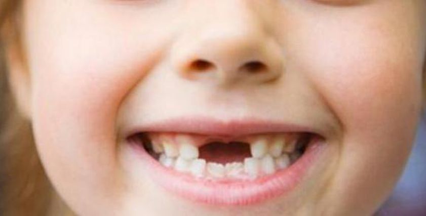 الأسنان اللبنية لدى الأطفال