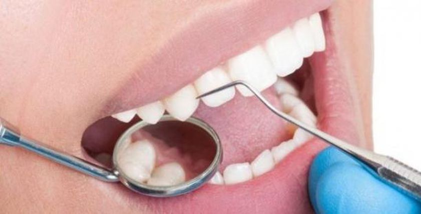 طرق تساعد على التخلص من البقع البيضاء على الأسنان