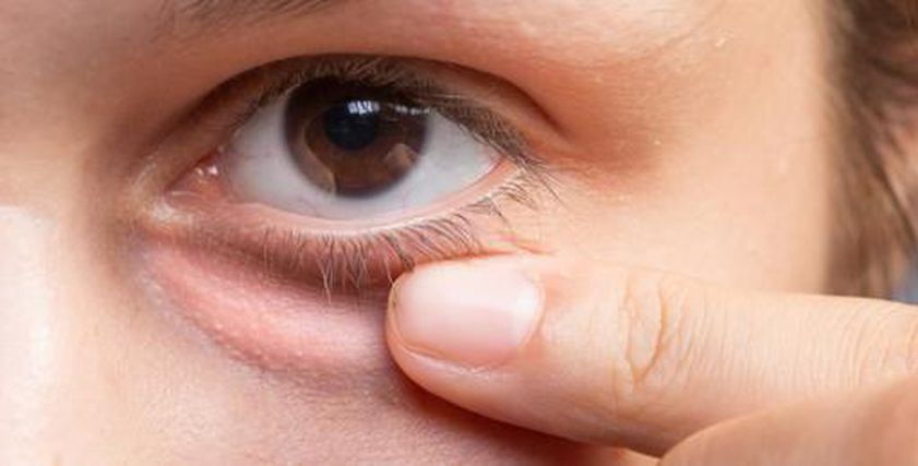 شكل العين يشير للإصابة بالأمراض