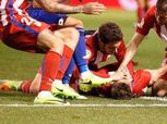 بالصور| أتلتيكو مدريد يكشف مدي إصابة فيرناندو توريس