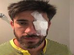 بالفيديو| لاعب بوكا جونيورز يتعرض لإصابة خطيرة في عينه
