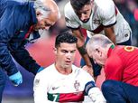 إصابة دموية لكريستيانو رونالدو في مباراة البرتغال والتشيك «فيديو»