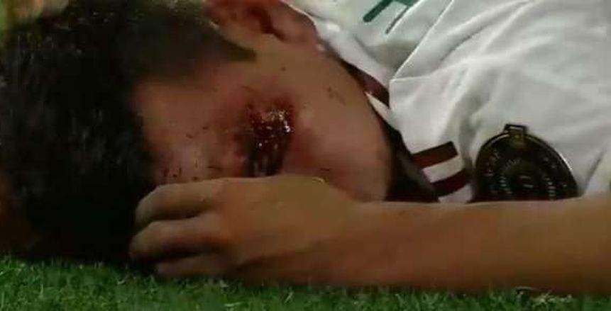 إصابة مرعبة لـ هرفينج لوزانو لاعب المكسيك في الكأس الذهبية «فيديو»