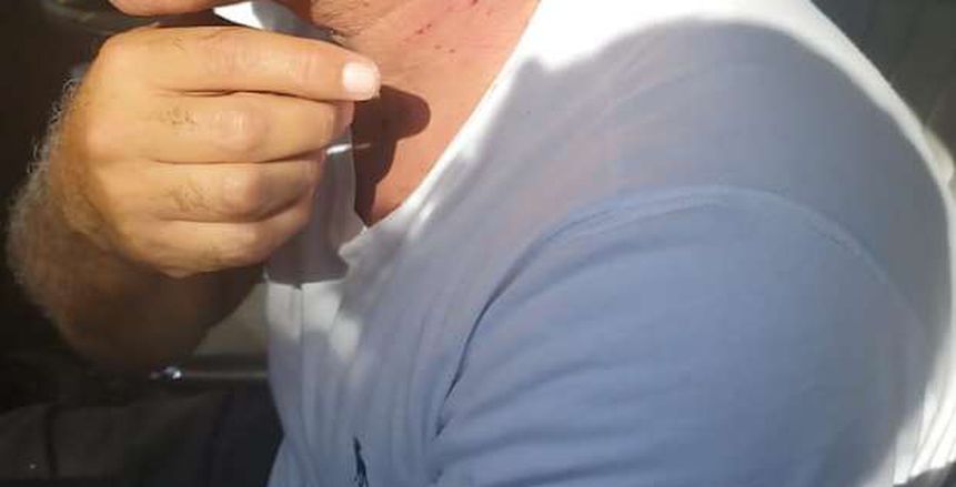 الاعتداء على أيمن يونس بعد صلاة الجمعة وإصابته بجروح (صور)