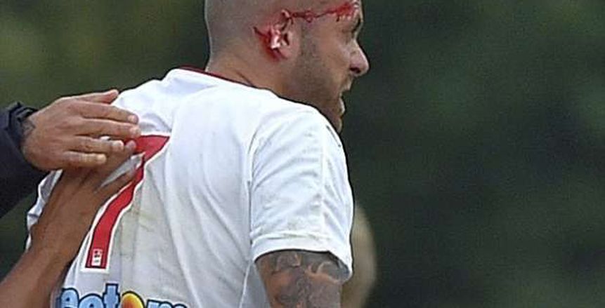 بالصور| عملية جراحية للاعب بوردو بعد تعرضه لقطع أذنه