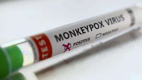اختبار المستضدات والمناعة الإنزيمية.. طرق الكشف عن الإصابة بجدري القرود