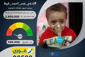 الطفل عمر أحمد مريض ضمور العضلات «دوشين»