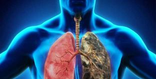 الفرق بين رئة المدخن والرئة السليمة