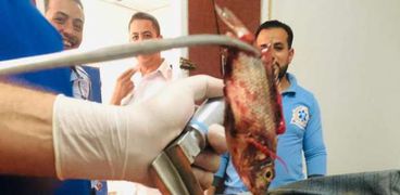استخراج سمكة حية من قصبة مزارع الهوائية بمستشفى بني سويف التخصصي