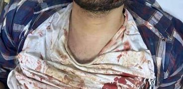 قاتل طالبة جامعة المنصورة وهو في المستشفي