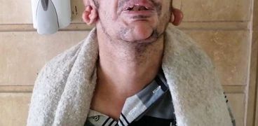 أورام حميدة تنتشر في جسد «ياسر» وتهدد حياته: محتاج عملية بتكلفة 35 ألف جنيه