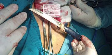 استخراج سكين من بطن مريض