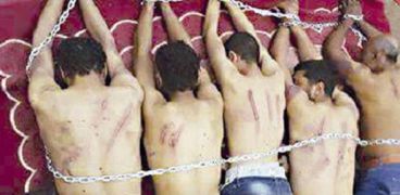 آثار التعذيب تظهر على أجساد عدد من المختطفين فى ليبيا