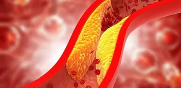 خفض نسبة الكوليسترول في الدم