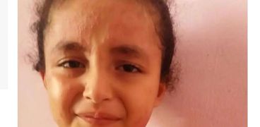 الطفلة الفلسطينية المصابة بمرض جلدي