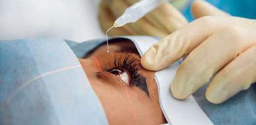 جراحة مبتكرة لعلاج جحوظ العينين
