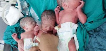 ولادة ثلاث توائم في المنوفية