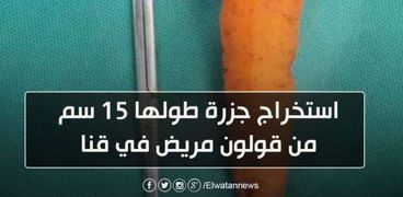 جزرة 15 سم ومفك وسيخ.. جراحات غريبة شهدتها مستشفيات مصرية