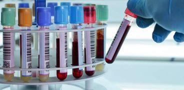 تحليل عينة دم - أرشيفية