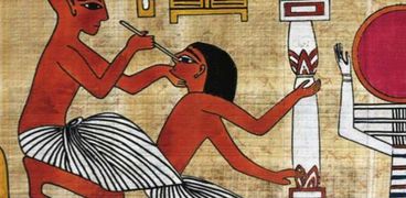 جراحة المخ عند المصريين القدماء