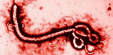 فيروس إيبولا يمكن أن يصيب الأعضاء التناسلية البشرية