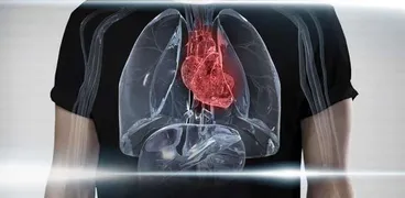 مريض قلب- أرشيفية