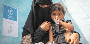 اليمن أكثر الدول العربية التي تعاني من انعدام الغذاء