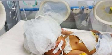 إجراء عملية مخية لطفل يبلغ5 ايام بمستشفي الغردقة