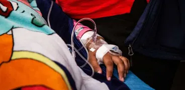 ذراع فتاة مصابة بمرض حمى الضنك في إحدى دول المحيط الأطلسي