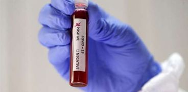 دراسة تقول أن فصيلة الدم «A» أكثر عرضة للإصابة بكورونا