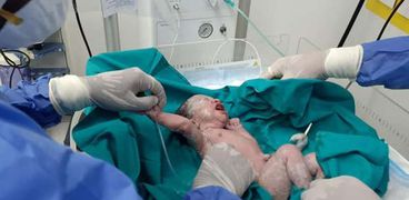 مولود بمستشفى العزل