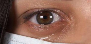 تأثير كورونا على العيون - صورة أرشيفية
