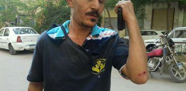نباش يصيب عامل نظافة أثناء تأدية عمله شرق الإسكندرية