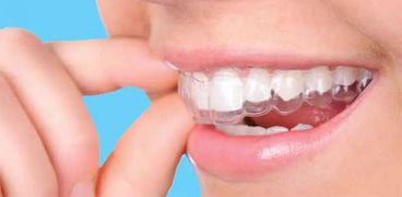 تركيبات الأسنان- تعبيرية