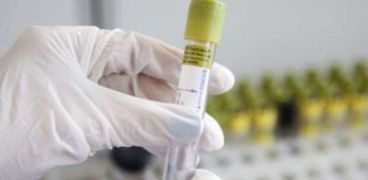 اختبارات صينية تكشف فيروس «لاني» الجديد