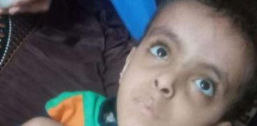 عبدالرحمن محمد.. طفل مصاب بضمور في المخ