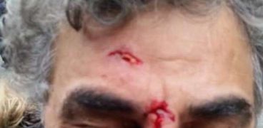 علاء ثابت بعد تعرضه للاعتداء على يد الجماعة الإرهابية