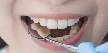 الأسنان